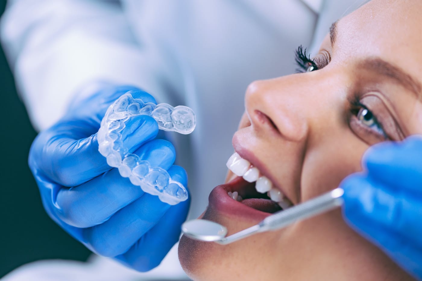Teeth Whitening in Leesburg VA | Dr. Ahmed Al Attar
